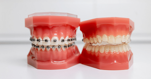 Orthodontic Solutions in Geneva