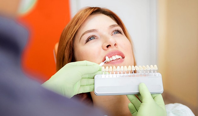 dental veneer treatment of female client