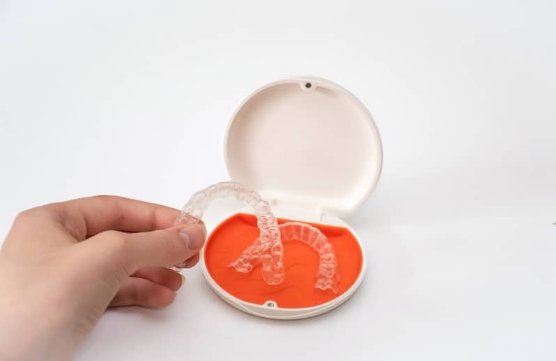 why timing matters in invisalign treatment