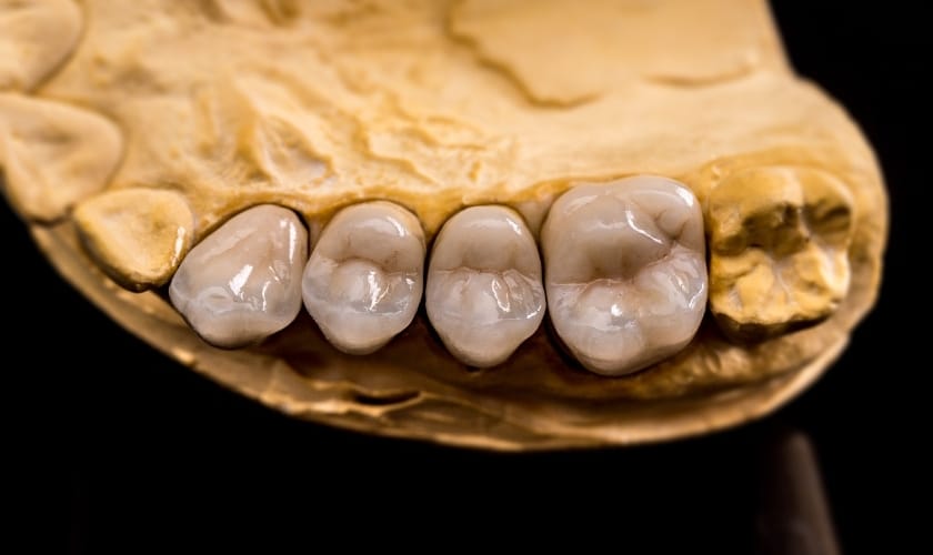 emergency dentist in Geneva